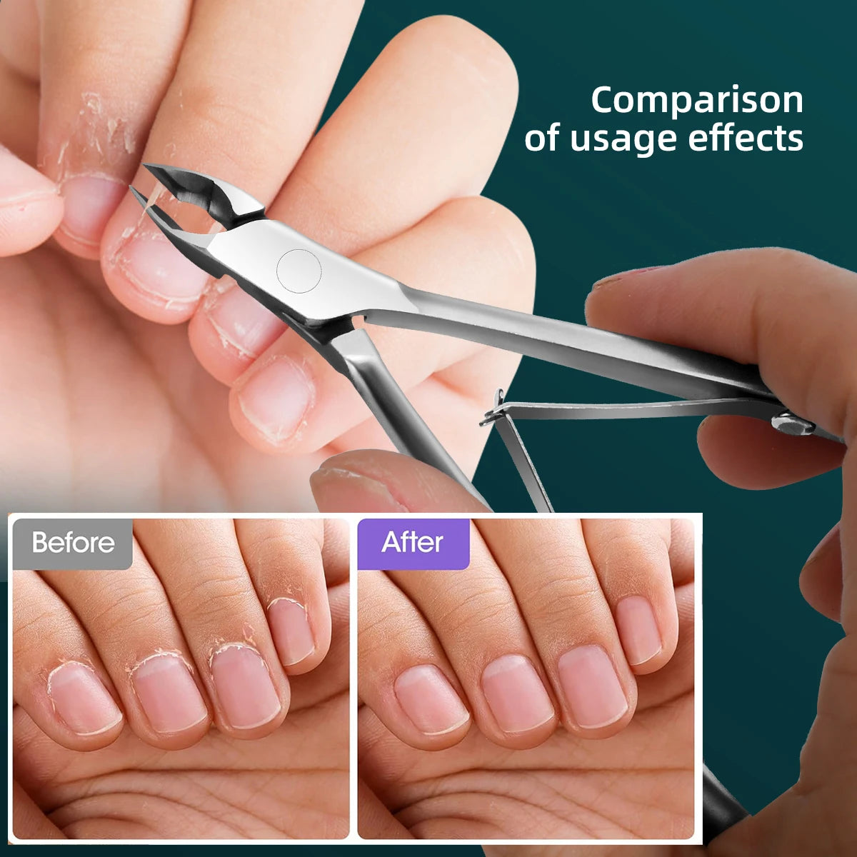 Professional Nail Cuticle Scissors | Stainless Steel Double Fork Cuticle Clipper