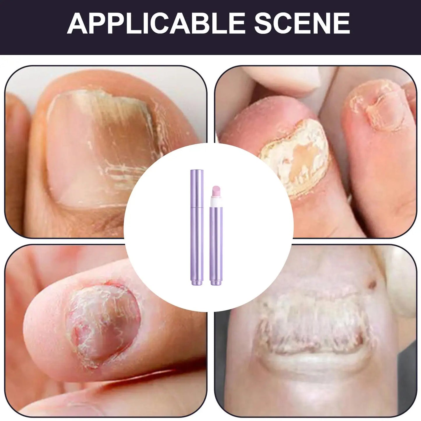 3in-1 Cuticle Oil Pen Nail Strengthener Damaged Nail Care Chip-resistant Dead Skin Cuticle Remover Pen For Nourishing Split
